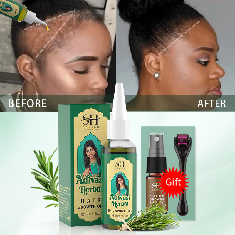 Ayurvedic Hair Growth Oil Indi - Ayurvedic & Herbal Wellness Kits 评论和价格