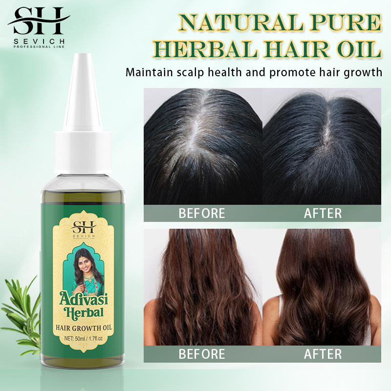 Ayurvedic Hair Growth Oil Adiv - Ayurvedic & Herbal Wellness Kits 评论和价格